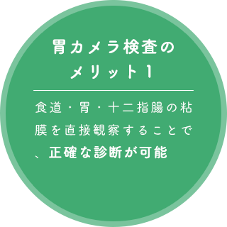 胃カメラ検査のメリット1