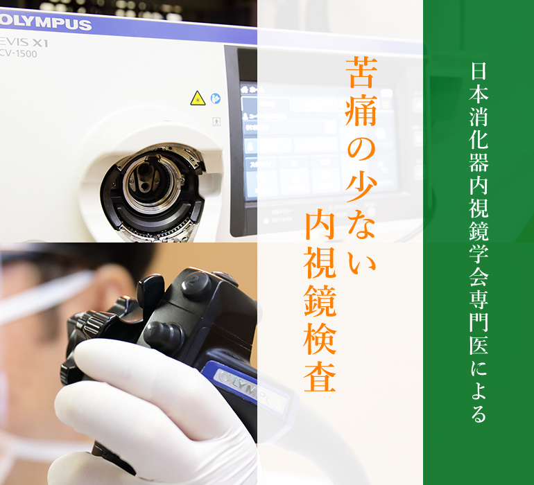 日本消化器内視鏡学会専門医による苦痛の少ない内視鏡検査