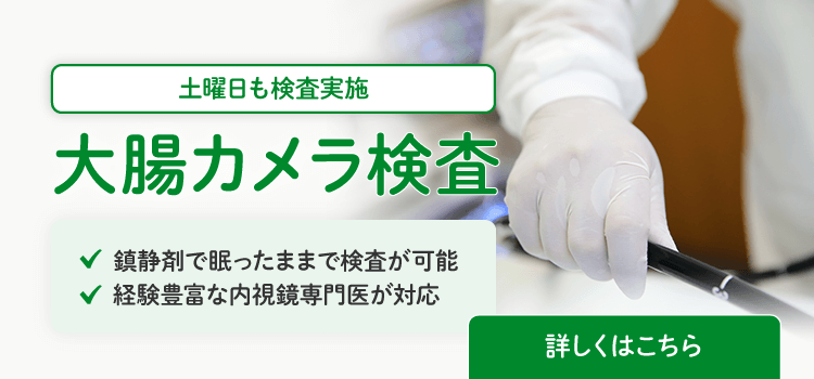 大腸カメラ検査